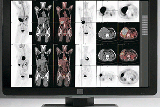 Barco Intros Coronis Fusion Medical-imaging Display