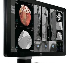 Barco Debuts 6MP Display for Healthcare Market