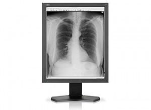 NEC Display Solutions aids accurate diagnostics image reporting with enhanced grayscale medical display