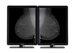 Barco Adds 5MP Display for Mammography