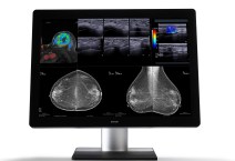 Barco debuts its 12MP Coronis Uniti Display System at 2015 China International Medical Equipment Fair