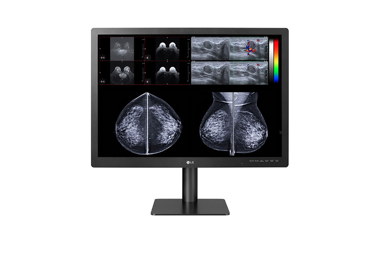 LG Expands Diagnostic Medical Monitor Line with New 12-Megapixel Multimodality Display