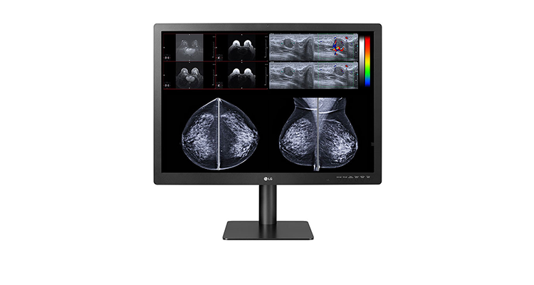 LG Releases Medical-Grade Diagnostic Monitor Optimized for 3D Mammography