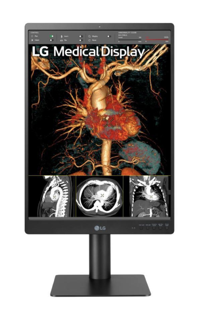 LG Unveils Oxide-Based TFT Digital X-Ray Detector, New 3MP Diagnostic Monitor at RSNA 2021
