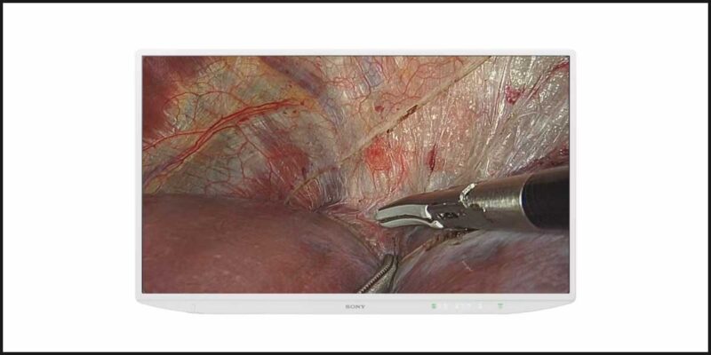 Sony Announces LMD-XH550MD Surgical Monitor