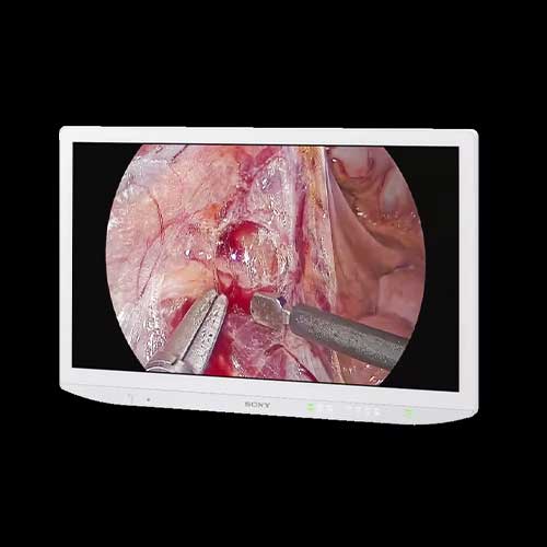 sony lmd 32m1md 32 inch monitor
